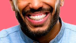 However, braces can seriously benefit your long term health and oral hygiene so many patients consider the expense to be worth it! What It S Like Living With Adult Braces Dollar Shave Club Original Content