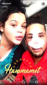 Photo : Eddy après son opération de chirurgie, Snapchat, mars 2017