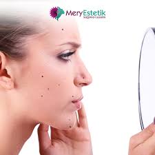 CO2 Fraksiyonel Lazer ile Ben Alımı Nedir?