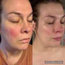 Renew 122 Health and Wellness, LLC