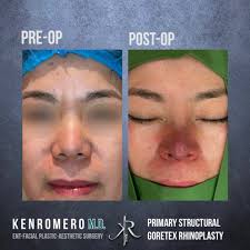 Dr. Ken Romero ENT FACE MD