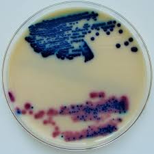 6 8b Viable Cell Counting Biology Libretexts