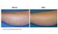 Tend Skin Solution Results