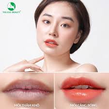 Trước khi phun môi nên làm gì? BVTM Thu Cúc chia sẻ