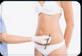 Benefits of Tummy Tuck: Your Complete Guide – Dr. Paulo Michels Plastic  Surgery