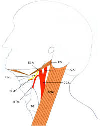 There are two carotid arteries, one on the right and one on the left. Unusual Origin Of The Arteries In The Carotid Triangle Of The Neck A Case Report And Literature Review Fulltext