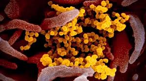 We don't know if b117 is more deadly, but we do have evidence it's transmitting fast. Cdc Issues Warning On New Covid 19 Variant B117 Abc13 Houston