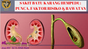 Fungsi lemon ialah untuk menumpulkan batu karang supaya tak mencederakan organ dalaman semasa proses keluar dari tubuh badan. Rawat Batu Karang Hempedu Ketahui Punca Faktor Risiko Dan Cara Rawat Coach Bisnes Coach Detox Kurus Coach Penyusuan Susu Ibu Mentor Bisnes Pengedar Shaklee Pengedar Youth Pengedar Vivix 011 17547669