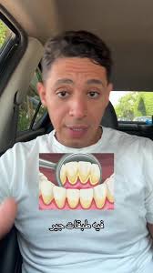 ليه اسنانك بتكون صفرا او سودا في المكان ده ! @Oral-B Arabia . . .  #dr_ashazly #explore #cairo #dubai #egypt #health_hacks #healthtips  #عيادة_اسنان #dentist #saudiarabia🇸🇦 #saudia #fyp #fypシ゚ #صحة ...