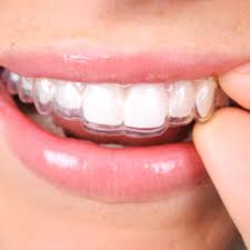 Review 10 best clear retainers providers. Dentist In Uptown Dallas Tx All Ppo Insurance Accepted Katy Trail Dental How Long Do I Need To Wear My Retainers