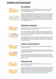 Die deutlichsten unterschiede aber sind die jeweiligen ursachen, welche zu diesen formveränderungen führen und meist ist es so, wird die grundursache erkannt und behandelt verschwinden auch in vielen fällen die erscheinungen. Schwierige Nagelformen Modellage Zur Idealform