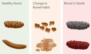 Image result for blood in stool human poop