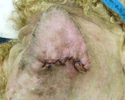 Ear Surgery In Dogsthe Veterinary Expert Pet Health