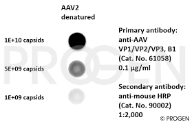 Image result for Black 1999 AAV