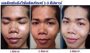 The price of the cleanser is about the same as their purifying cleanser. Sr Review à¸ à¸ˆà¸à¸£à¸£à¸¡ Workshop Eucerin White Therapy Clinical à¹à¸¥à¸°à¸œà¸¥à¸¥ à¸žà¸˜ à¸«à¸¥ à¸‡à¹ƒà¸Š Pantip
