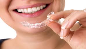 From these impressions, your dentist and his/her team will make your invisible aligners. Noticeable Results How Fast Does Invisalign Work