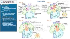 Image result for Endocardial Cushion Defect