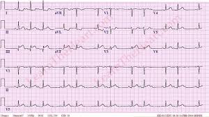 We have a big heart at the institute and lots of answers. Case 01 Question 1 Learn The Heart