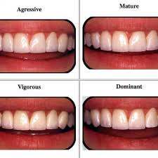 How To Choose The Best Veneers For Your Face Shape Rifkin