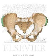 Image result for Risser Sign