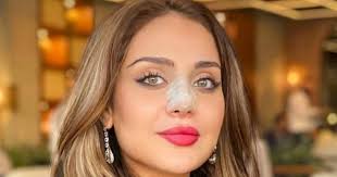 هنادي مهنا قبل عمليات التجميل. ØµÙˆØ± Ø¬Ø¯ÙŠØ¯Ø© Ù„Ù€ Ø²ÙŠÙ†Ø¨ ÙÙŠØ§Ø¶ Ø¨Ø¹Ø¯ Ø¹Ù…Ù„ÙŠØ© ØªØ¬Ù…ÙŠÙ„ Ø£Ù†ÙÙ‡Ø§ Et Ø¨Ø§Ù„Ø¹Ø±Ø¨ÙŠ