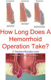 Should I Go To The Doctor For A Hemorrhoid Hemorrhoid Remedies Bleeding Hemorrhoids Hemorrhoids Treatment