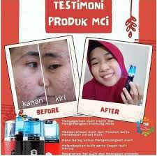 Glucola Nano Spray Magic Stik Mci Distributor Jakarta Jl Swadaya Iii 2021