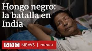 Extirpan a gregorio ojo y tejido por sospecha de hongo covid; Hongo Negro La Epidemia Mortal Contra La Que Luchan En Los Hospitales En India En Medio De La Pandemia De Covid 19 Bbc News Mundo