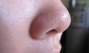 Membuat pes dengan mencampurkan serbuk kunyit dengan susu. 5 Cara Menghilangkan Bintik Hitam Blackhead Di Muka