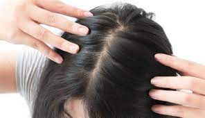 فوائد زيت الخروع للشعر الخفيف لهلوبه