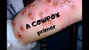 The virus is zoonotic, meaning that it is transferable between species, such as from cat to human. A Cowpox Primer Outbreak News Today
