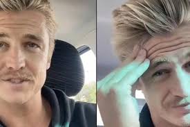 Nick har ikke vasket håret på 6 år: Slik ser det ut