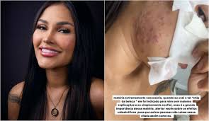 Flay desabafa sobre efeitos do chip da beleza: 'cilada'