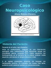 We did not find results for: Afasia Motora Eferente Afasia Ciencia Cognitiva