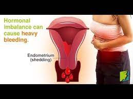 How To Stop Menstrual Bleeding Immediately Heavy Bleeding Heavy Menstrual Bleeding Perimenopause