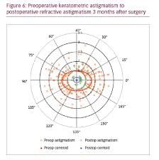 Management Of Astigmatism With The Lensar Laser System With