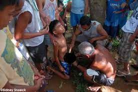 Male Circumcision in the Philippines - Why the Health department requires  it - HubPages