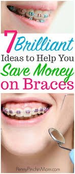 Saving Money On Braces And Expanders Saving Money Best Money Saving Tips Braces