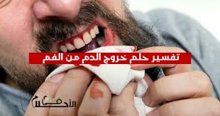 يشير خروج الدود من الأنف في المنام إلى استعادة الثقة بالنفس بعد فترة طويلة من الضعف و الانكسار، أو دلالة على التقدم و التطور بعد فترة من الركود و الجمود، أيضاً يرمز المنام إلى الفرج و حصول الحالم على مطالب كانت صعبة المنال. ØªÙØ³ÙŠØ± Ø­Ù„Ù… Ø®Ø±ÙˆØ¬ Ø§Ù„Ø¯Ù… Ù…Ù† Ø§Ù„ÙÙ… ÙÙŠ Ø§Ù„Ù…Ù†Ø§Ù… ÙÙŠ Ø§Ù„Ø§Ø­Ù„Ø§Ù…