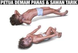 Sejak dari pengalaman ngeri ni, memang jaga betul bila mardhiyah demam, petua merawat anak demam, tips merawat anak demam, petua rawat anak demam, petua merawat bayi demam selsema. Norsalina Md Ali Ibu Bapa Wajib Baca Ni Petua Demam Panas Sawan Tarik Tanda Tanda Demam Panas 1 Suhu Badan 37 C Dan Ke Atas 2 Badan Dan Kepala Panas