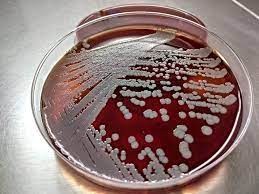 Aureus, haemolytic streptococci and enterococci. Staphylococcus Aureus On Columbia Cna Agar With 5 Sheep Blood Microbiology Pictures Microbe Notes