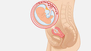 10 Weeks Pregnant Symptoms Baby Development Tips Babylist