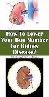 Surprising Tricks Kidney Cleanse Link Kidney Disease Essential Oils Kidney Stones News Kidney F In 2020 Kidney Cleanse Chronic Kidney Disease Kidney Disease Awareness