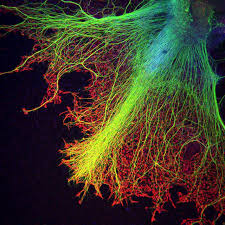 Neurons Growing Over Astrocytes In A Human Stem Cell Embryo Body 2011 Photomicrography Competition Nikon S Smal Microscopic Photography Neurons Microscopic