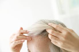 You may have to take estrogen and progesterone products to reverse or stop your hair loss. Everything You Need To Know About Female Receding Hairlines Martha Stewart