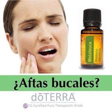 Aftas Bucales Aceites Esenciales Doterra Aceites Esenciales Propiedades Recetas De Aceites Esenciales