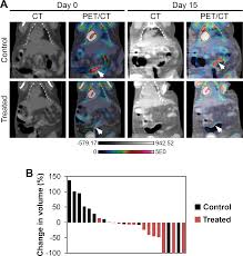 The pet scan indicates whether there is strong uptake of sugar and is, thus, useful in diagnosing the presence of most cancers. Plos One Colon Cancer Tumorigenesis Initiated By The H1047r Mutant Pi3k