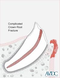 Avdc Nomenclature Avdc Org