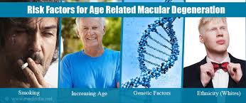 Image result for images Age-Related Macular Degeneration Risk