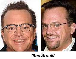 19 Celebrities Who Probably Have Had Hair Transplants Hair Transplant Hair Transplant Surgery Laser Hair Removal